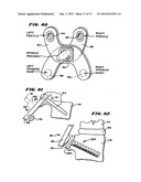 Facet Arthroplasty Devices and Methods diagram and image