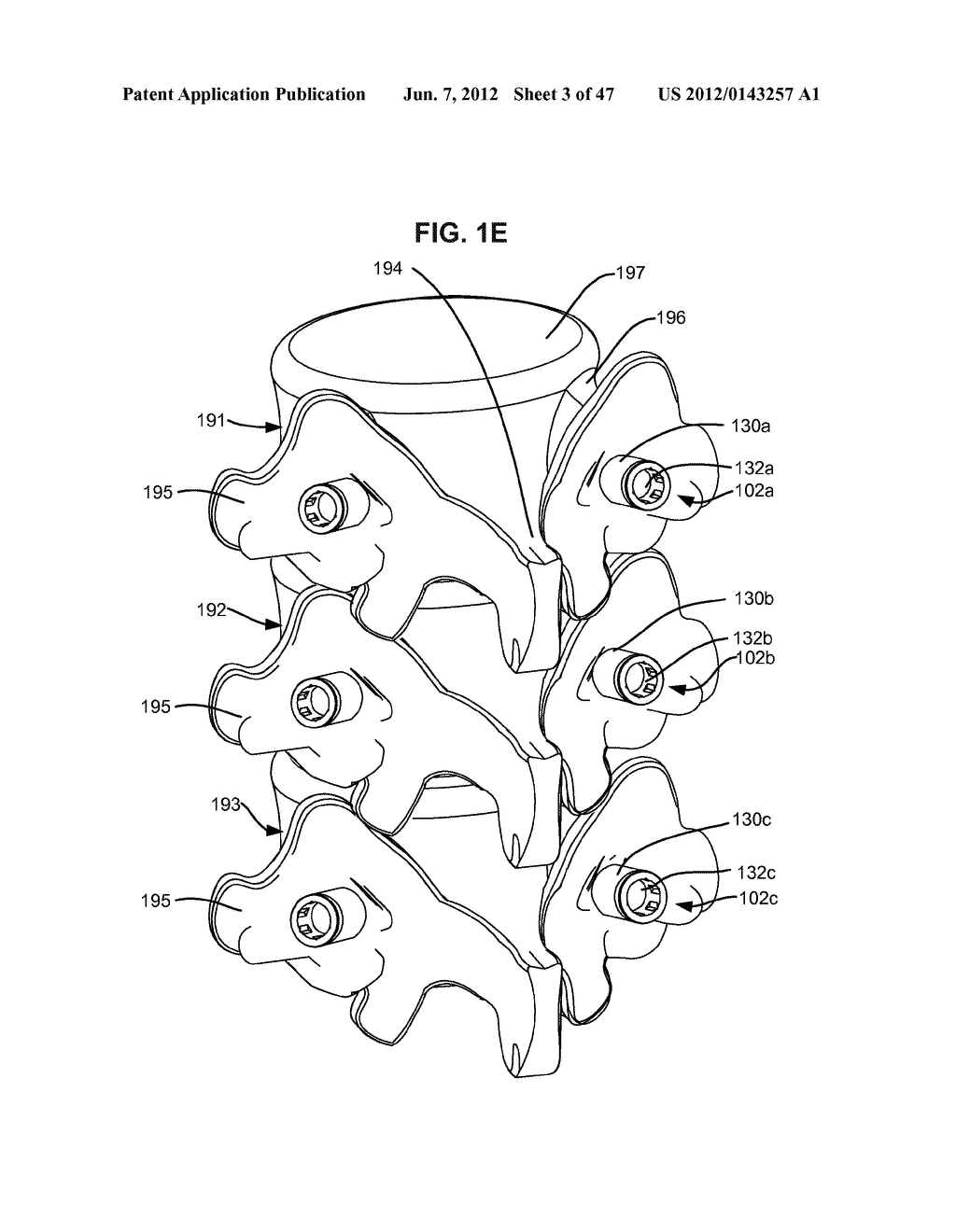 LOW PROFILE SPINAL PROSTHESIS INCORPORATING A CANNULATED BONE ANCHOR     HAVING A DEFLECTABLE POST AND A COMPOUND SPINAL ROD - diagram, schematic, and image 04