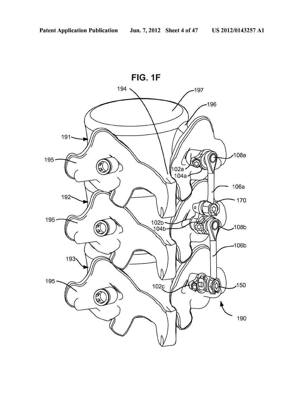 LOW PROFILE SPINAL PROSTHESIS INCORPORATING A CANNULATED BONE ANCHOR     HAVING A DEFLECTABLE POST AND A COMPOUND SPINAL ROD - diagram, schematic, and image 05