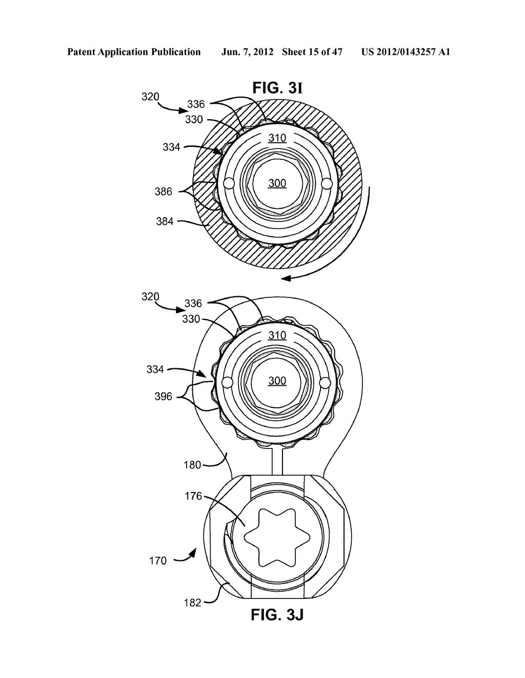 LOW PROFILE SPINAL PROSTHESIS INCORPORATING A CANNULATED BONE ANCHOR     HAVING A DEFLECTABLE POST AND A COMPOUND SPINAL ROD - diagram, schematic, and image 16