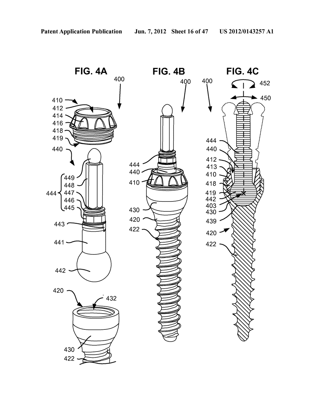 LOW PROFILE SPINAL PROSTHESIS INCORPORATING A CANNULATED BONE ANCHOR     HAVING A DEFLECTABLE POST AND A COMPOUND SPINAL ROD - diagram, schematic, and image 17