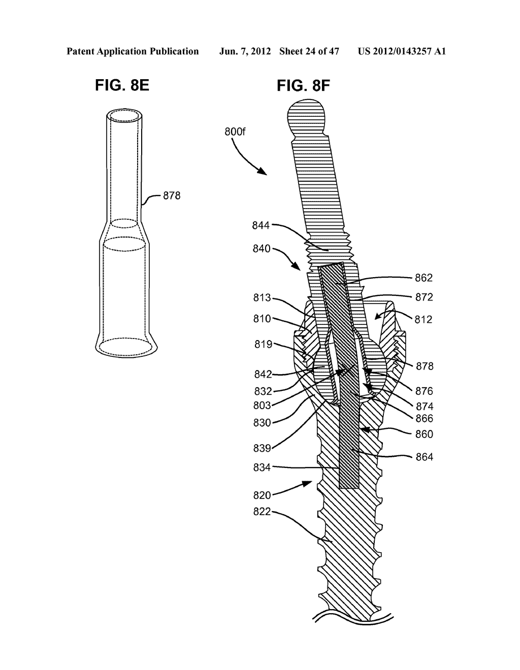 LOW PROFILE SPINAL PROSTHESIS INCORPORATING A CANNULATED BONE ANCHOR     HAVING A DEFLECTABLE POST AND A COMPOUND SPINAL ROD - diagram, schematic, and image 25