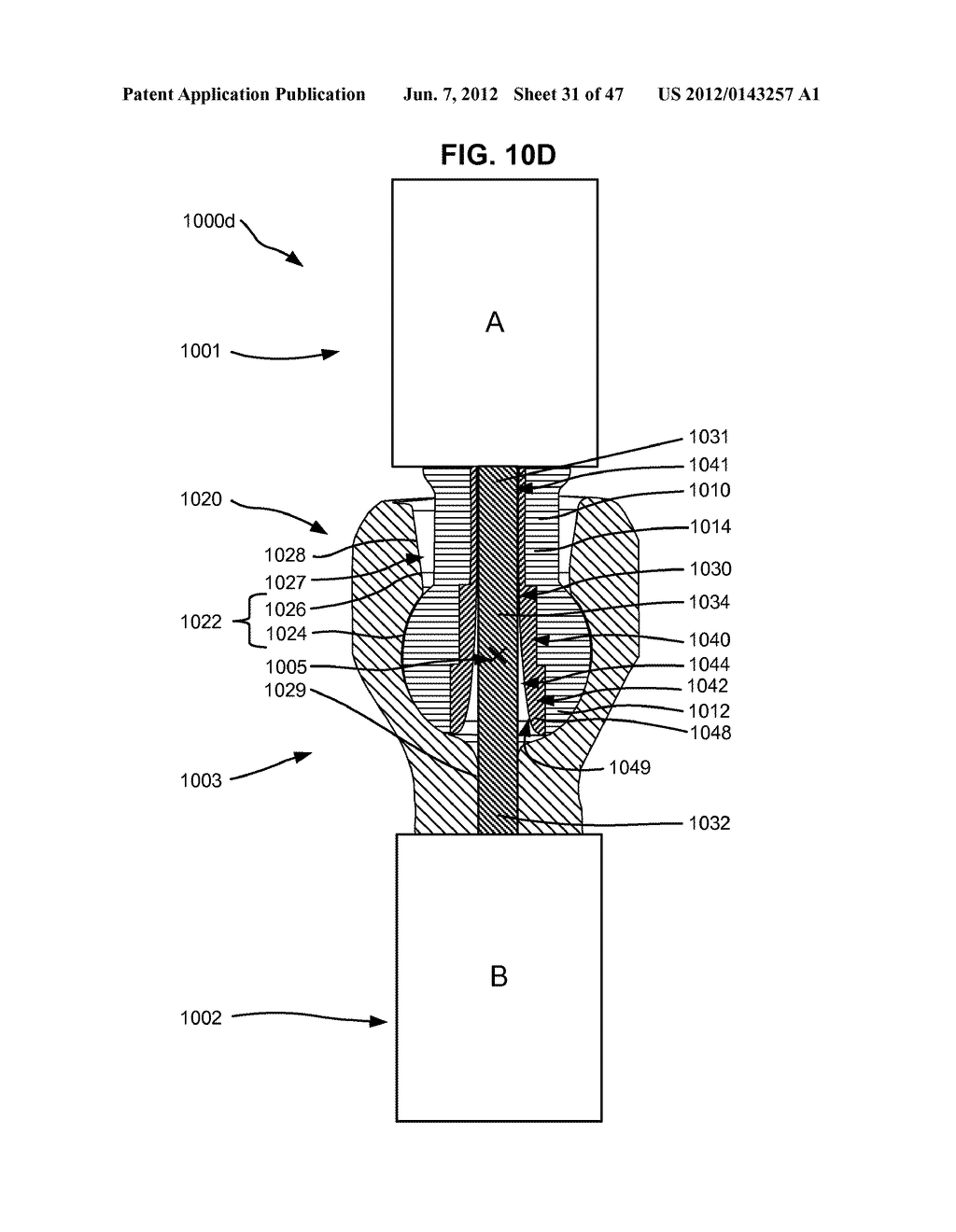 LOW PROFILE SPINAL PROSTHESIS INCORPORATING A CANNULATED BONE ANCHOR     HAVING A DEFLECTABLE POST AND A COMPOUND SPINAL ROD - diagram, schematic, and image 32