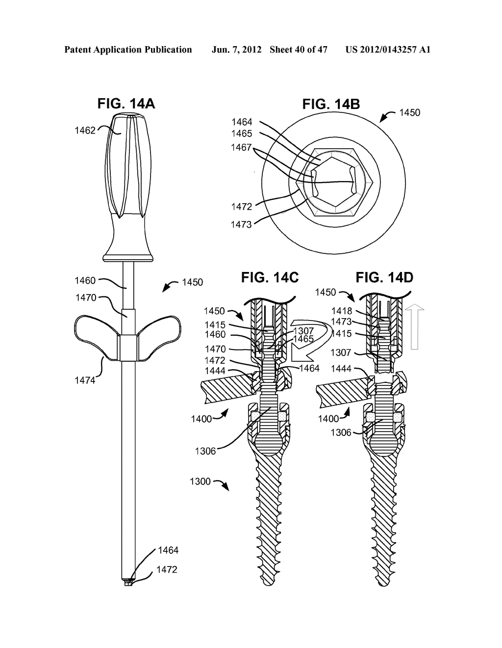 LOW PROFILE SPINAL PROSTHESIS INCORPORATING A CANNULATED BONE ANCHOR     HAVING A DEFLECTABLE POST AND A COMPOUND SPINAL ROD - diagram, schematic, and image 41