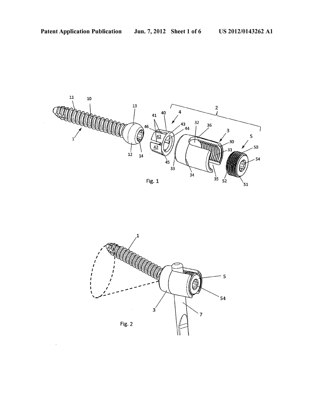 VARIABLE ANGLE BONE SCREW FIXATION ARRANGEMENT - diagram, schematic, and image 02