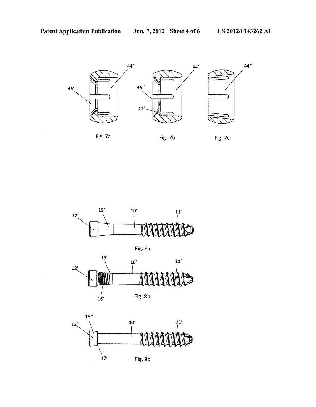 VARIABLE ANGLE BONE SCREW FIXATION ARRANGEMENT - diagram, schematic, and image 05