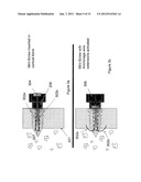 SCREW diagram and image