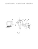 IMPLANT STIMULATION DEVICE diagram and image