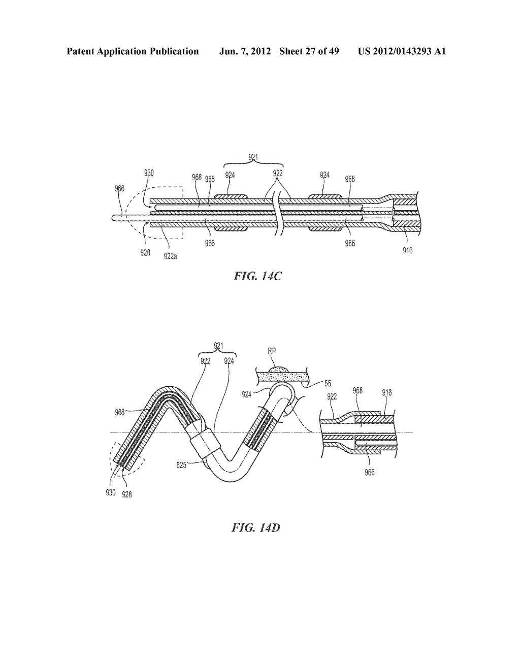 CATHETER APPARATUSES HAVING MULTI-ELECTRODE ARRAYS FOR RENAL     NEUROMODULATION AND ASSOCIATED SYSTEMS AND METHODS - diagram, schematic, and image 28