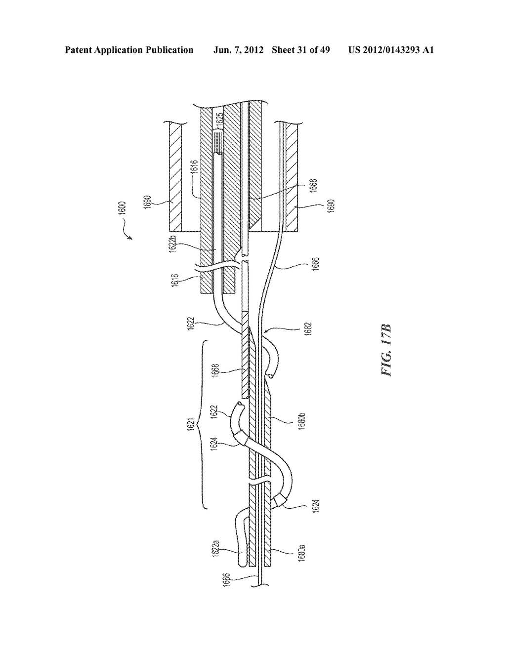 CATHETER APPARATUSES HAVING MULTI-ELECTRODE ARRAYS FOR RENAL     NEUROMODULATION AND ASSOCIATED SYSTEMS AND METHODS - diagram, schematic, and image 32