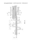 CATHETER APPARATUSES HAVING MULTI-ELECTRODE ARRAYS FOR RENAL     NEUROMODULATION AND ASSOCIATED SYSTEMS AND METHODS diagram and image