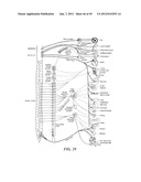 CATHETER APPARATUSES HAVING MULTI-ELECTRODE ARRAYS FOR RENAL     NEUROMODULATION AND ASSOCIATED SYSTEMS AND METHODS diagram and image