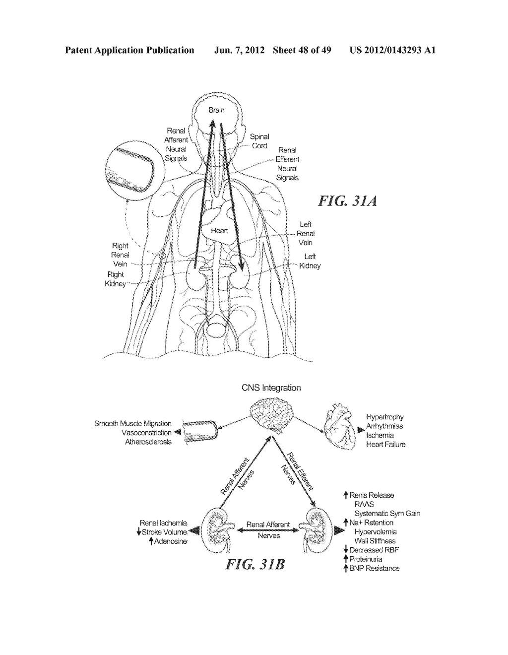 CATHETER APPARATUSES HAVING MULTI-ELECTRODE ARRAYS FOR RENAL     NEUROMODULATION AND ASSOCIATED SYSTEMS AND METHODS - diagram, schematic, and image 49