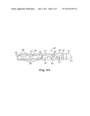 MRI COMPATIBLE CO-RADIALLY WOUND ELECTRODE CIRCUIT diagram and image