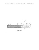 MRI COMPATIBLE CO-RADIALLY WOUND ELECTRODE CIRCUIT diagram and image