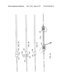 VASCULAR REPAIR DEVICES diagram and image