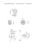 VASCULAR REPAIR DEVICES diagram and image