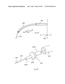 VASCULAR REPAIR DEVICES diagram and image