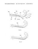 VASCULAR REPAIR DEVICES diagram and image