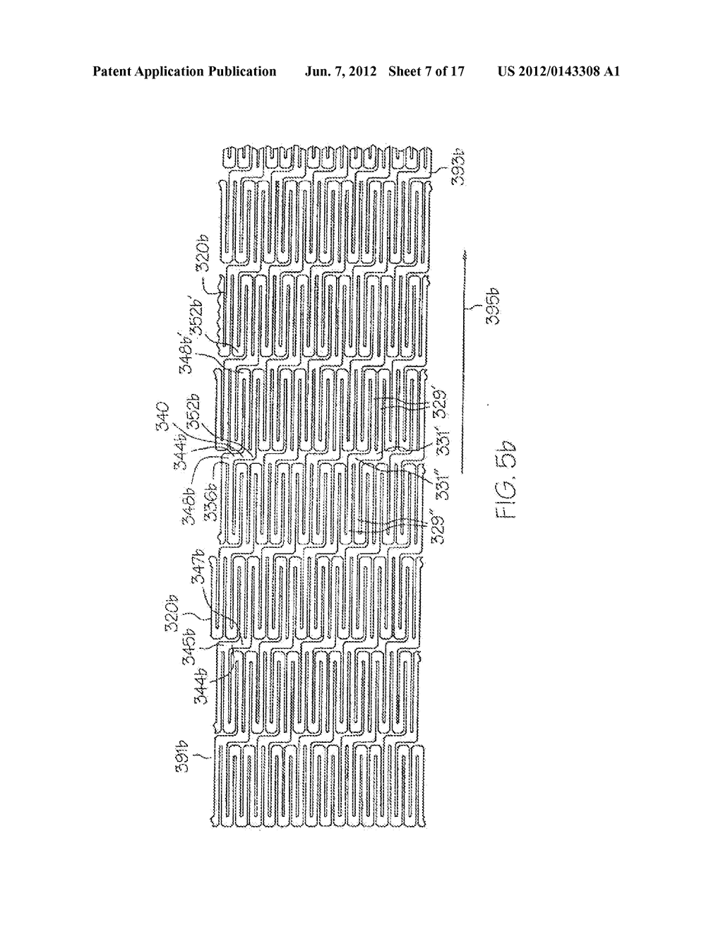 LONGITUDINALLY FLEXIBLE EXPANDABLE STENT - diagram, schematic, and image 08