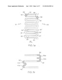 LONGITUDINALLY FLEXIBLE EXPANDABLE STENT diagram and image