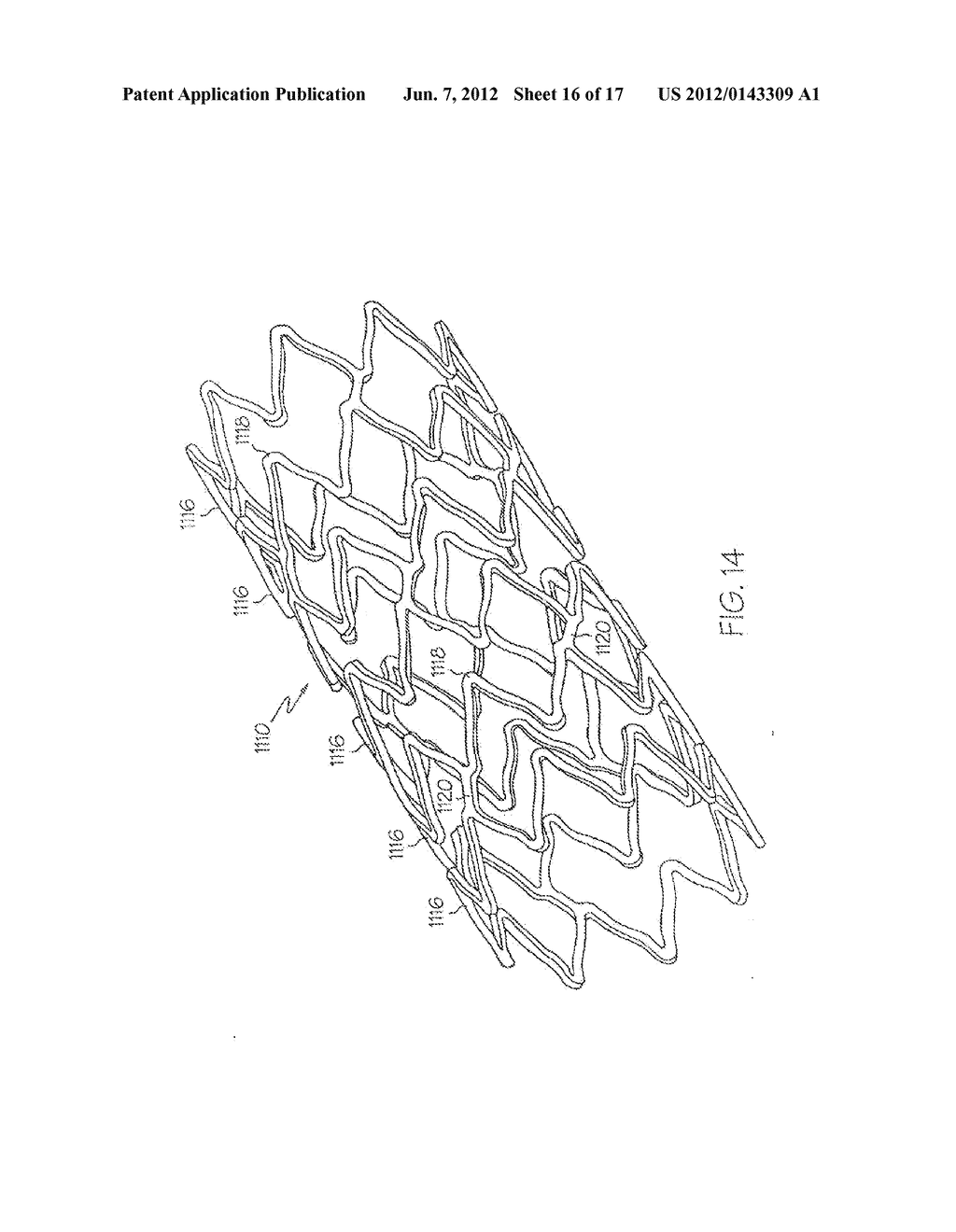 LONGITUDINALLY FLEXIBLE EXPANDABLE STENT - diagram, schematic, and image 17