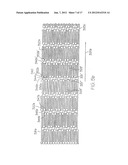 LONGITUDINALLY FLEXIBLE EXPANDABLE STENT diagram and image