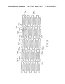 LONGITUDINALLY FLEXIBLE EXPANDABLE STENT diagram and image