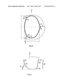 Aortic Valve Devices diagram and image