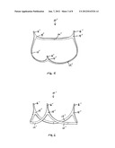 Aortic Valve Devices diagram and image