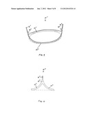 Aortic Valve Devices diagram and image