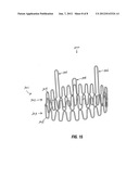 Aortic Valve Devices diagram and image