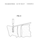 INTERVERTEBRAL LIGAMENT HAVING A HELICAL BONE FASTENER diagram and image