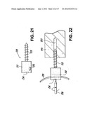 SHAPED LOAD-BEARING OSTEOIMPLANT AND METHODS OF MAKING THE SAME diagram and image