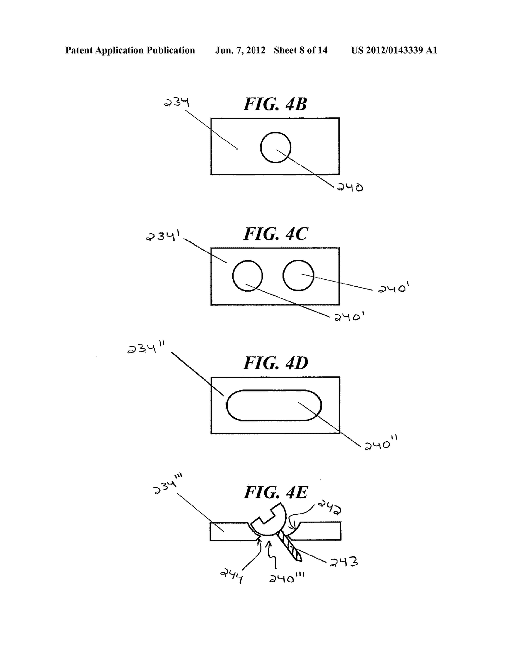 METHODS AND DEVICES FOR EXPANDING A SPINAL CANAL - diagram, schematic, and image 09