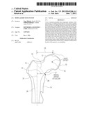 MODULAR HIP STEM SYSTEM diagram and image