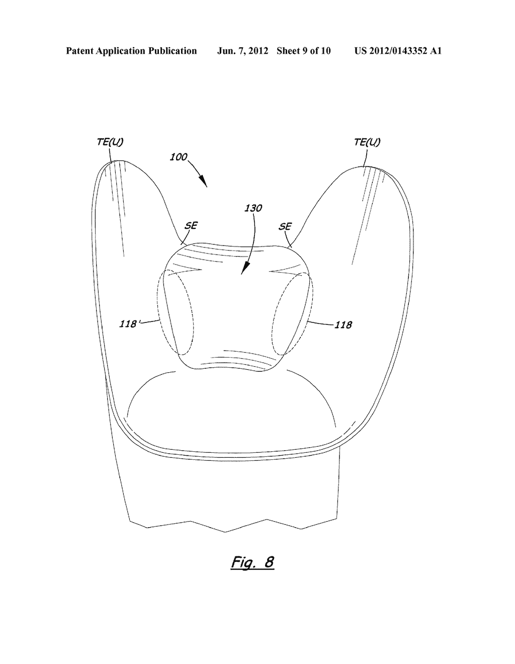 TRANSTIBIAL SOCKET FOR EXTERNAL PROSTHESIS - diagram, schematic, and image 10