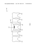 SYSTEMS, METHODS, APPARATUSES, AND COMPUTER-READABLE STORAGE MEDIA FOR     DESIGNING AND MANUFACTURING CUSTOM DENTAL PREPARATION GUIDES diagram and image