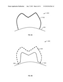 SYSTEMS, METHODS, APPARATUSES, AND COMPUTER-READABLE STORAGE MEDIA FOR     DESIGNING AND MANUFACTURING CUSTOM DENTAL PREPARATION GUIDES diagram and image