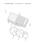 SYSTEMS, METHODS, APPARATUSES, AND COMPUTER-READABLE STORAGE MEDIA FOR     DESIGNING AND MANUFACTURING CUSTOM DENTAL PREPARATION GUIDES diagram and image