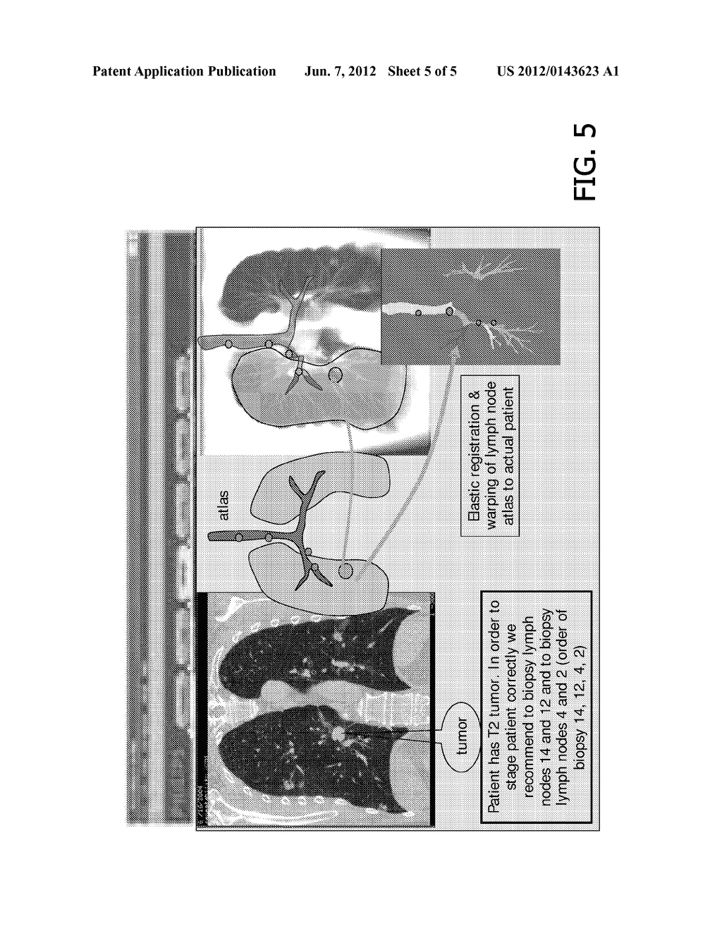 RULE BASED DECISION SUPPORT AND PATIENT-SPECIFIC VISUALIZATION SYSTEM FOR     OPTIMAL CANCER STAGING - diagram, schematic, and image 06