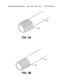 SELECTIVELY RIGIDIZABLE AND ACTIVELY STEERABLE ARTICULATABLE DEVICE diagram and image