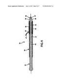 TRACHEOSTOMA SPACER, TRACHEOTOMY METHOD, AND DEVICE FOR INSERTING A     TRACHEOSTOMA SPACER diagram and image