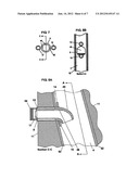 TRACHEOSTOMA SPACER, TRACHEOTOMY METHOD, AND DEVICE FOR INSERTING A     TRACHEOSTOMA SPACER diagram and image