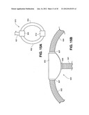 SOUND DAMPENING IN POSITIVE AIRWAY PRESSURE DEVICES diagram and image