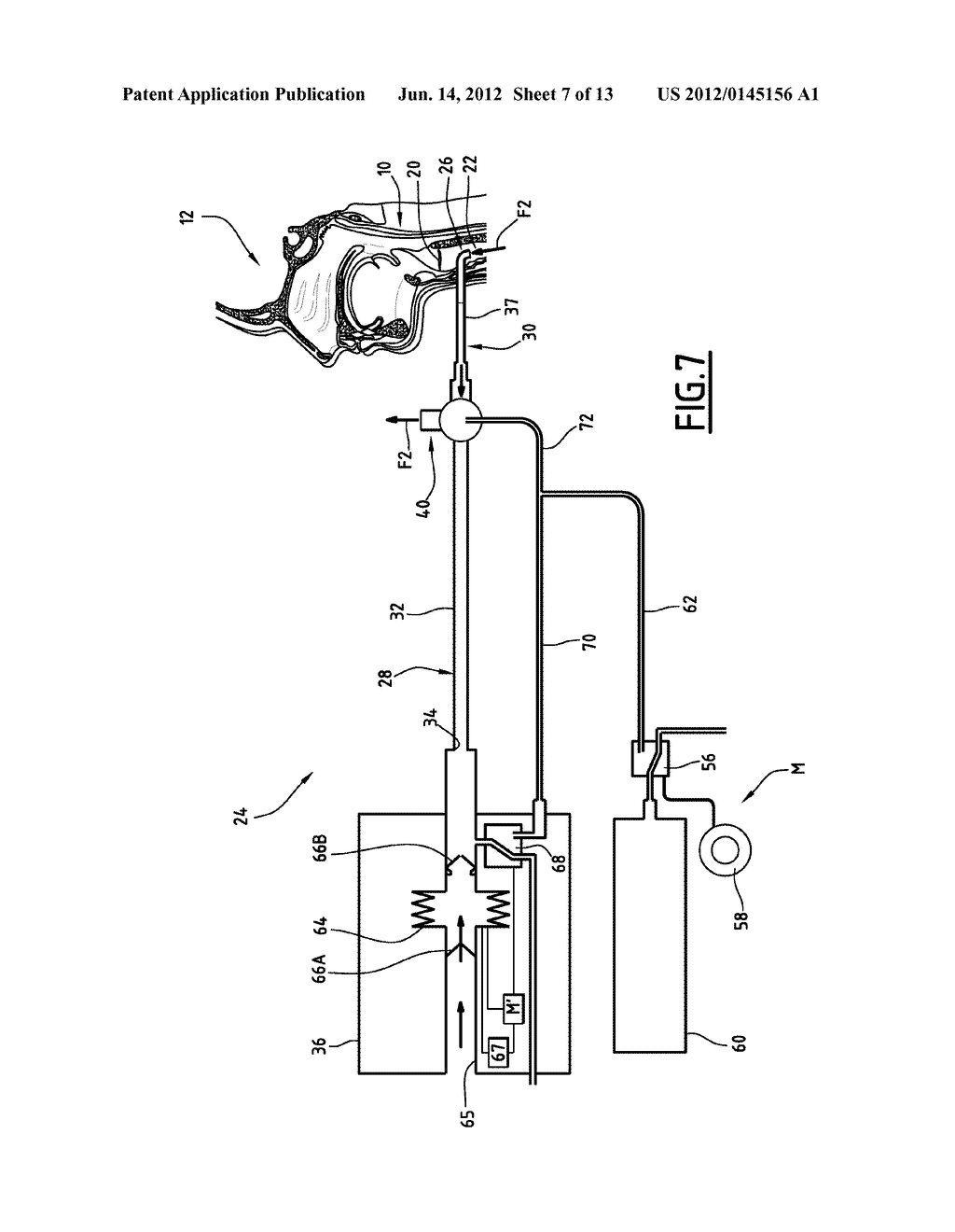 PHONATION ASSISTANCE DEVICE FOR A TRACHEOTOMY PATIENT - diagram, schematic, and image 08