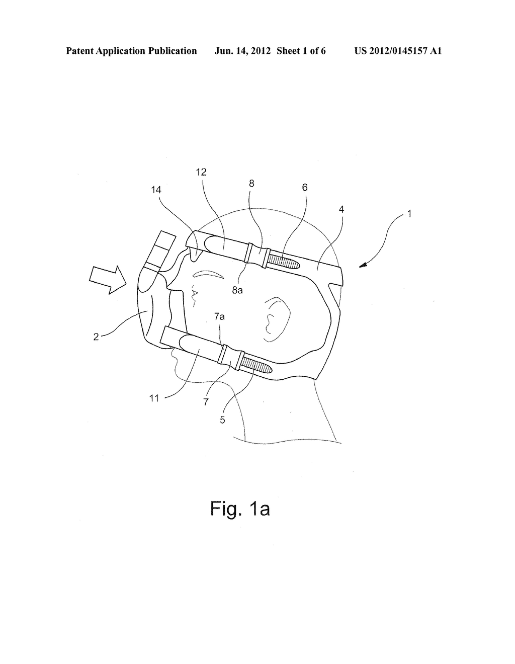 HEADBAND DEVICE FOR AN OXYGEN MASK, AND METHOD FOR THE PRODUCTION THEREOF - diagram, schematic, and image 02