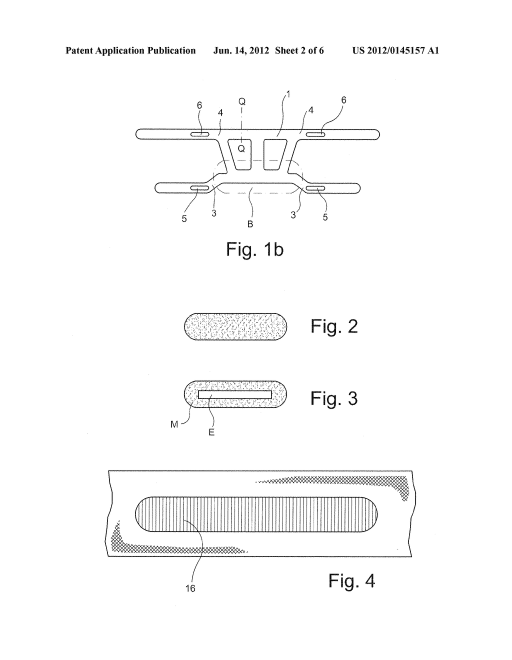 HEADBAND DEVICE FOR AN OXYGEN MASK, AND METHOD FOR THE PRODUCTION THEREOF - diagram, schematic, and image 03