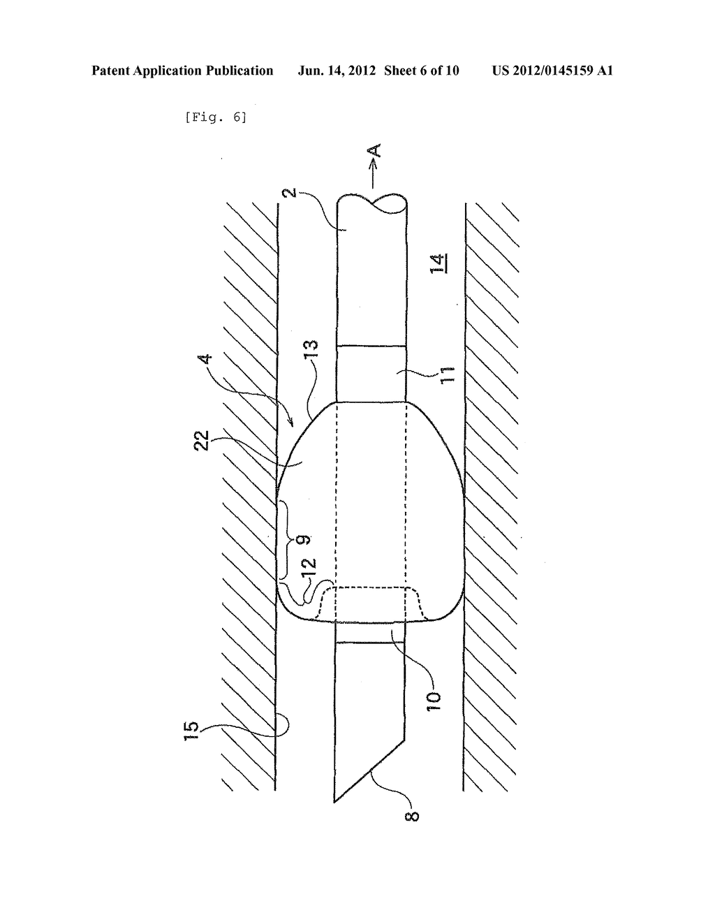 Cuff-Equipped Tube - diagram, schematic, and image 07