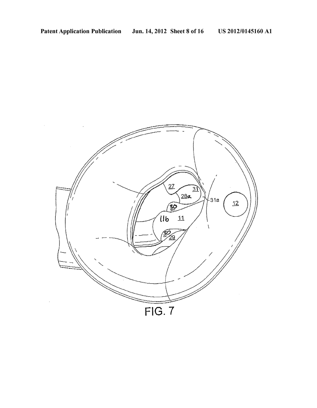 LARYNGEAL MASK AIRWAY DEVICE - diagram, schematic, and image 09